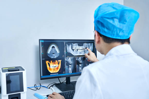 Best Emergency Tooth Extraction in Santa Claus, IN